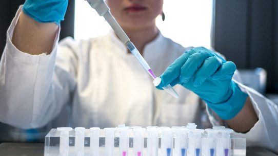 scientist using pipette with test tubes in lab